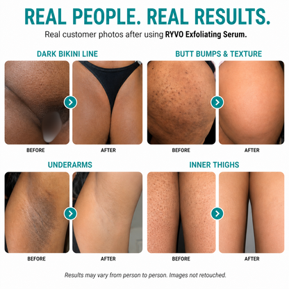 RYVO Reveal™ Body Peel